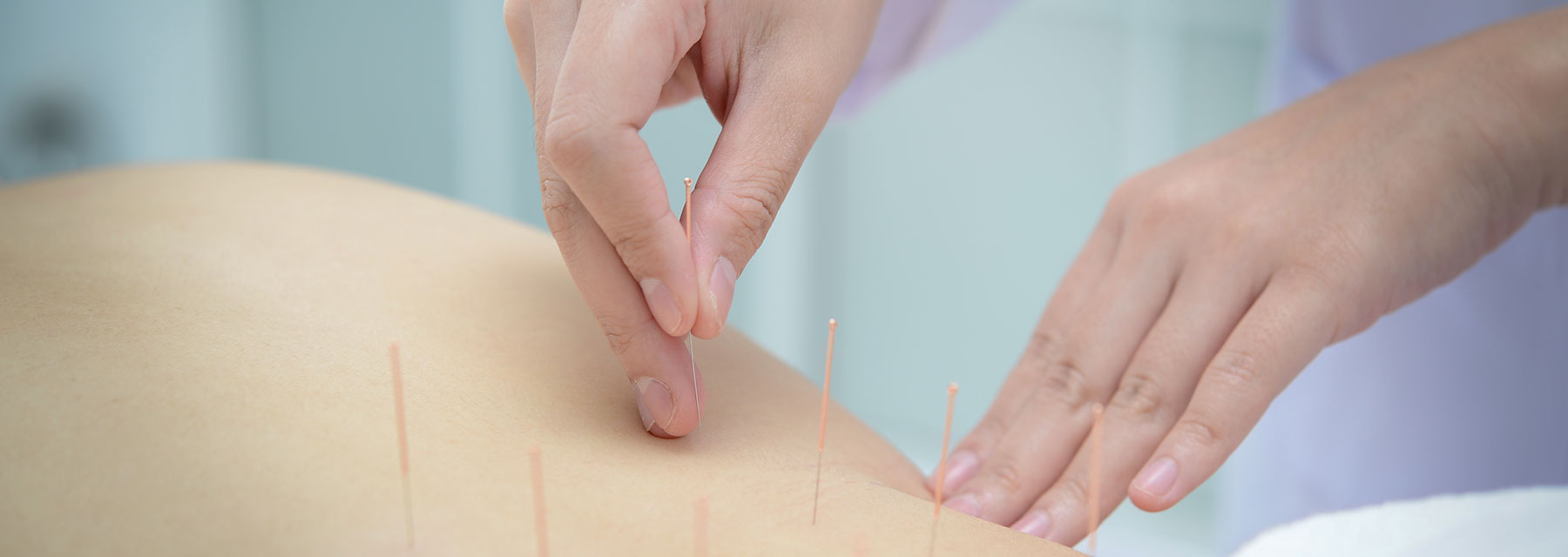 傷科針灸